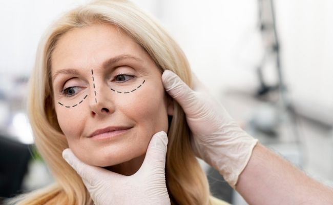 Imagen Blefaroplastia