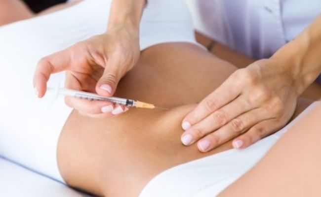 Carboxiterapia